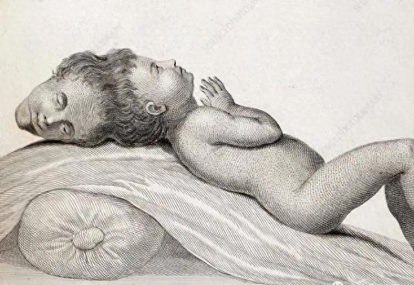 华星配资 印度一男孩出生后, 千万人付费观看, 死后解剖学家争相高价购买